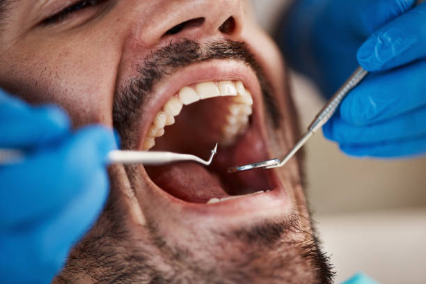 Best Emergency Dentist for Knocked-Out Tooth in Blairsville, PA