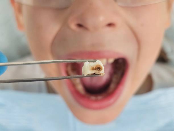 Best Weekend Emergency Dentist in Blairsville, PA